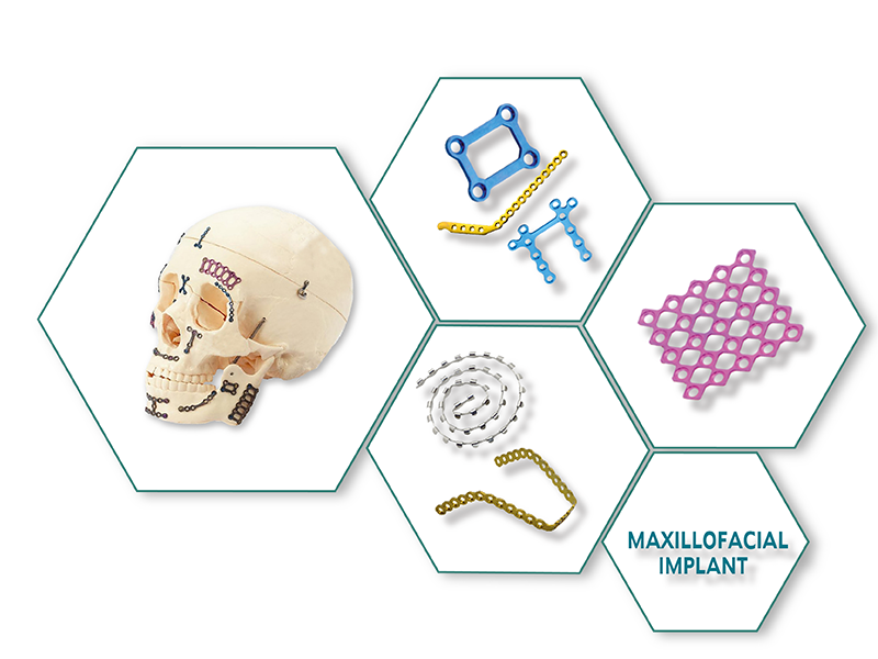 Maxillofacial Implants